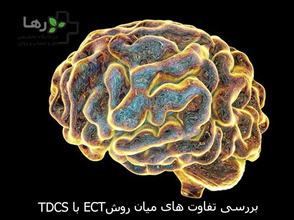 بررسی تفاوت های میان روش  TDCS با ECT