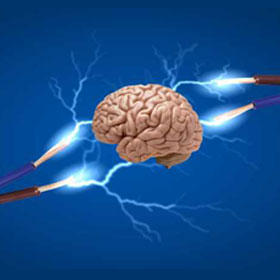 تحریک الکتریکی مغز