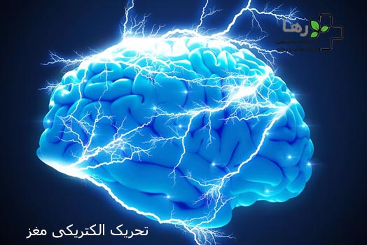 -الکتریکی-مغز.jpg