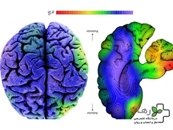 نقشه مغزی نرمال